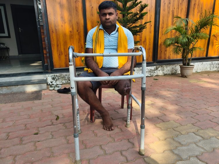 एक हादसे में अपना एक पैर गवां चुके पुरेन्द्र का रायपुर में लगेगा नया कृत्रिम पैर,  मुख्यमंत्री कैंप कार्यालय में प्रस्तुत आवेदन पर सुनिश्चित की गई आवश्यक कार्यवाही,,,
