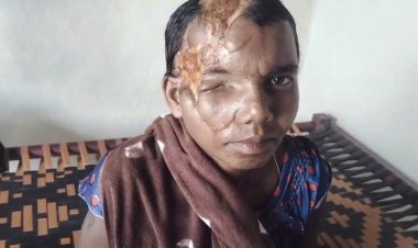 मानवता और संवेदनशील प्रशासन की मिसाल : भालू हमले की पीड़िता प्रेमबाई के घर पहुंचेगा जिला मेडिकल बोर्ड,  डॉ. अविनाश खरे ने दिखाई मानवीय संवेदना, दिव्यांग महिला को अब नहीं लगाने पड़ेंगे अस्पताल के चक्कर,